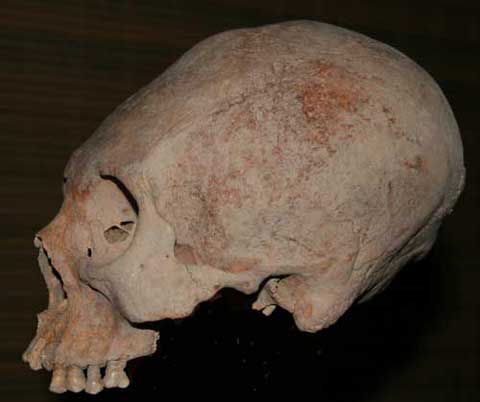 Cráneo de Colombia